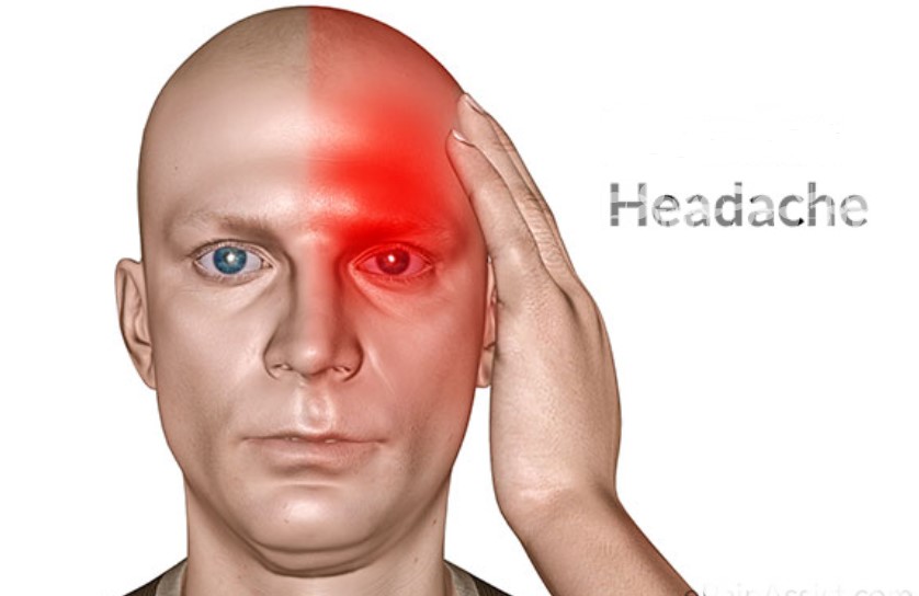 Cara mengobati sakit Kepala Sebelah atau Migran